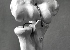 A detailed black and white view of the human knee joint anatomical model showcasing bone and ligament structures.