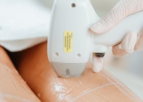 Close-up of laser hair removal treatment in a beauty clinic focusing on smooth legs.