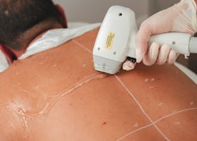 A professional performing laser hair removal on a male client in a beauty clinic.