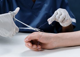 A healthcare professional carefully suturing a hand, showcasing precision in medical care.
