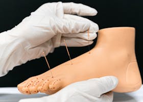 Close-up of a foot model with acupuncture needles inserted, demonstrating alternative therapy.